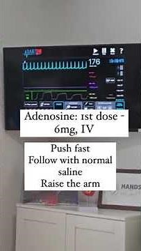 Supraventricular Tachycardia - ECG interpretation,