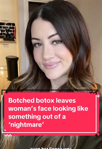 The Nightmare of Botched Botox: A Cautionary Tale
