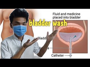What is the process of bladder wash #medical #no1trending