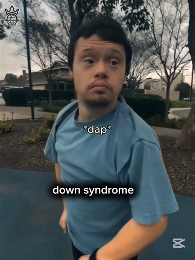down syndrome tries basketball 🏀🤯#basketball #downsyndrome #shorts