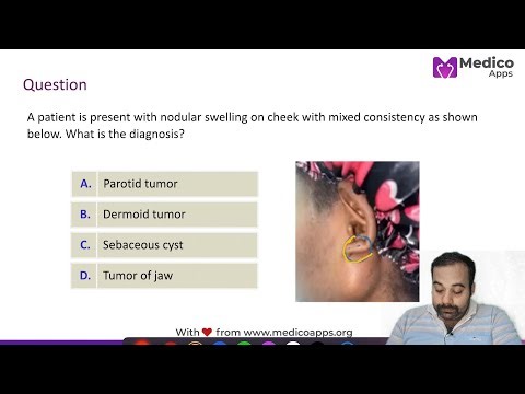 🩺 Surgery High Yield: Pleomorphic Adenoma | NEET PG 2025 | Dr. Soumya Banerjee