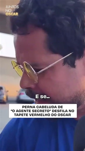 The hairy leg from 'The Secret Agent' parades down the Oscars red carpet.