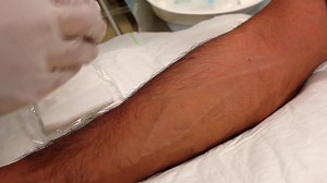 How to set an IV Cannulation Procedure - OSCE Exam Demonstration