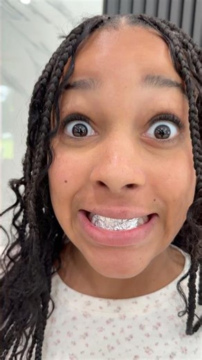 My daughter got Grills 😬😂