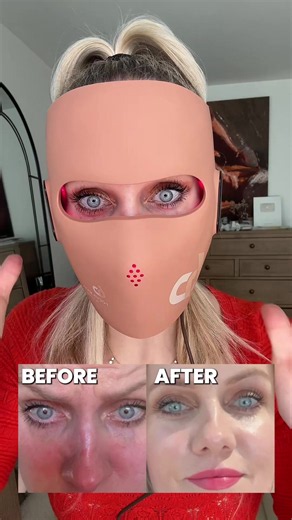 @JOVS laser EMS face mask = lifted skin, less pores, youthful looking skin and workout for your face muscles ✅ use code: GIN160 for $160 off #jovs #jovs6d #jovslasermask #jovsmask