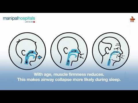 Snoring in Adults & Children | Dr. Debayan Tarafdar | Manipal Hospital Saltlake and Broadway