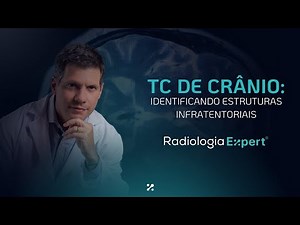 TC de Crânio: Identificando Estruturas Infratentoriais