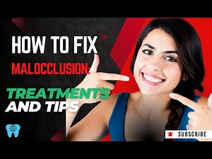 How to Fix Malocclusion: Treatments and Tips 🦷