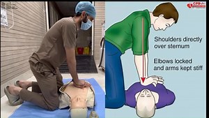A few simple steps can help you save a life! Watch this video to understand scene safety and learn how to perform CPR effectively. Let’s empower ourselves to respond when it matters the most. #cpr4life2025 Narendra Modi PMO India J.P.Nadda Anupriya Patel अनुप्रिया पटेल Press Information Bureau - PIB, Government of India Ministry of Information & Broadcasting, Government of India MyGovIndia DDNewsLive All India Radio News | Ministry of Health and Family Welfare, Government of India