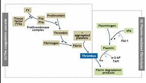 Hematologic Complications of Sepsis
