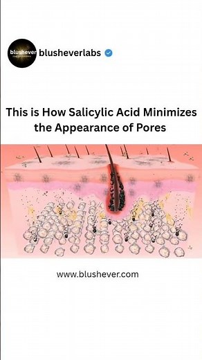 How Salicylic Acid Clears and Tightens Pores