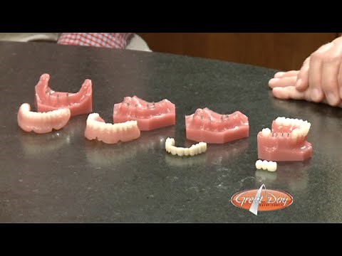 Mini Dental Implants, How They Work.