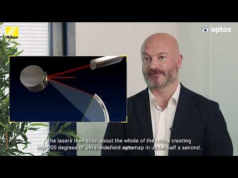 The clinical value of Optos ultra-widefield retinal imaging in DR screening and diagnosis.