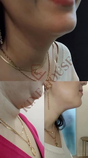 kine house on Instagram: "Débarrassez-vous du double menton grâce à notre protocole personnalisé de lifting du cou et du menton. Des résultats visibles en quelques séances seulement, sans injection et sans chirurgie. Pour plus d’information 0522861302 #DoubleMenton #LiftingSansChirurgie #SoinsDuCou #casablanca #BeautéMarocaine #RaffermissementVisage #AntiAgeNaturel #CasablancaSkinCare #EsthétiqueMaroc #SoinLifting #GlowNaturel #ContourVisage #SoinsProfessionnels #VisageAffiné #maroc"