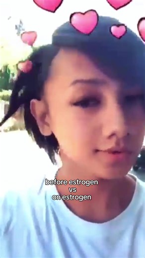 Understanding Estrogen Pills: Benefits and Uses