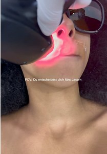 ✨✨ #Laserhaarentfernung #laserhairremoval #mannheim #heidelberg #frankfurt