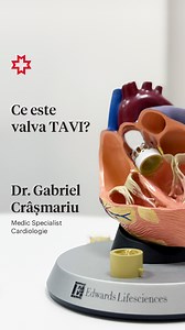 81K views · 76 reactions | TAVI este o procedură minim invazivă în cardiologia intervențională utilizată pentru tratarea stenozei aortice severe, prin înlocuirea valvei aortice cu o proteză valvulară. ‍⚕️Dr. Gabriel Crâșmariu, Medic Specialist Cardiologie, ne explică ce reprezintă valva TAVI și ne prezintă detalii despre aceasta. | Ponderas Academic Hospital | Facebook
