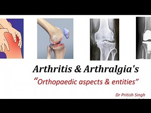 ARTHRITIS / ARTHRALGIA'S / Orthopaedics