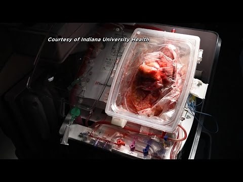 ‘Heart-In-Box’ Transplant Breakthrough