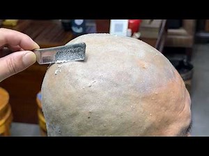 💈ASMR | Remove a lot of dead skin from a man's head and face! 🪒 Old fashioned razor wet shave