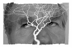 Mapping the Brain Before Surgery for Epilepsy | Neuroscience