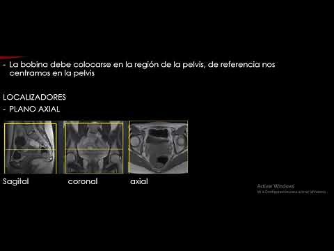 Protocolo de resonancia magnética pelvis femenina