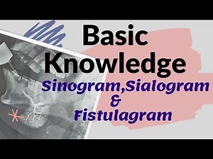 Basic knowledge of Sinogram, Sialogram & Fistulagram (Ep-51) |Sinography | Sialogram|Fistulagraphy