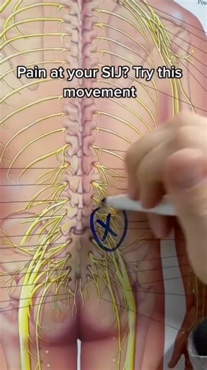 Struggling with SI joint pain? This simple move can help! Perform 30 repetitions daily to stabilize the joint, reduce discomfort, and reclaim comfortable movement. #fblifestyle #SIJoint #sijointpain #painrelief #homeexercise | Physical Therapy Session
