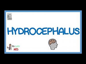 Hydrocephalus (Hydrodynamic CSF disorder)