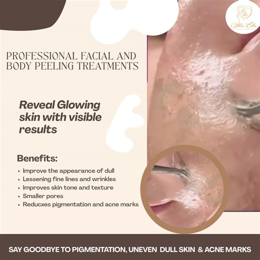 Achieve Radiant Skin with Chemical Peels
