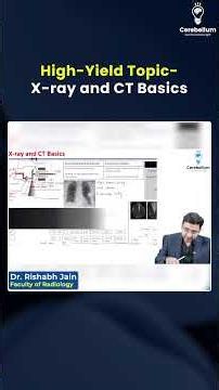High-Yield Radiology & Imaging: X-Ray, CT & Mammography Made Easy | NEET PG | FMGE | INI-CET