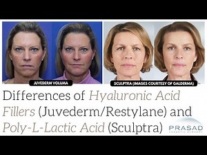 Differences of Juvederm Voluma and Sculptra in Time of Results, Predictability and Treatment Areas