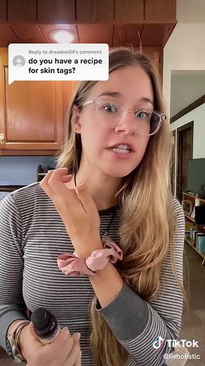 DIY Tea Tree Oil Skintag Hack for Skin Tags Removal