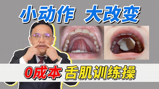【超实用】舌头放不对，会越来越丑，0成本教大家舌肌训练操！