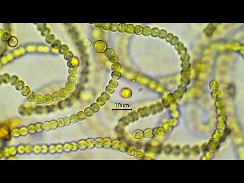 Nostoc commune - the nitrogen fixing cyanobacterium