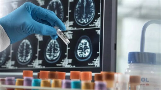 Alzheimer's disease detected in minutes: The blood test that can be a game-changer and how to do it