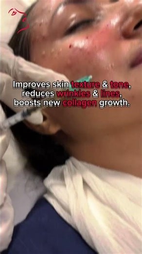 New to anti-aging treatments? Start here. PRP for complete facial rejuvenation!
