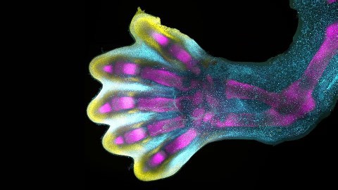 Stunning video reveals how our fingers form in the womb
