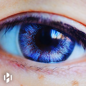 What causes color blindness?