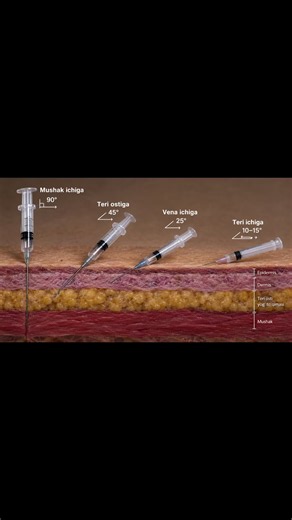How to Give an Injection Safely: Medical Student & Nurse Guide