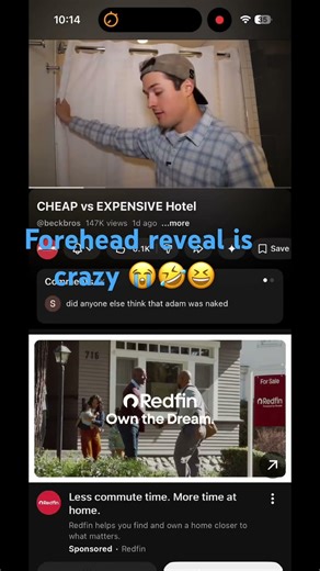 Crazy Beck Bros forehead reveal 😭😆🤣