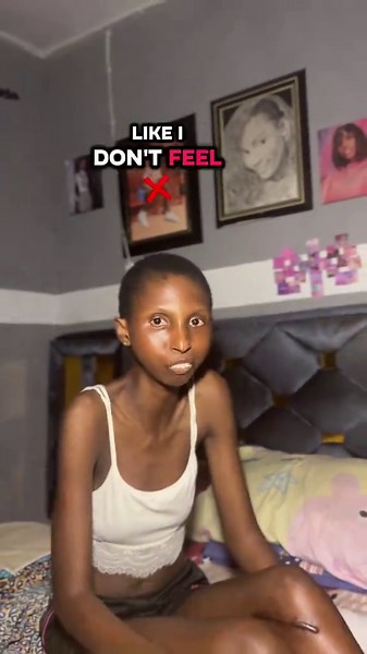 Life with Scleroderma 😩😢