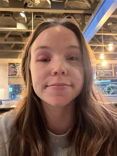 was a stye friday but now the stye is gone and i’m stuck here. crying | stye inspo