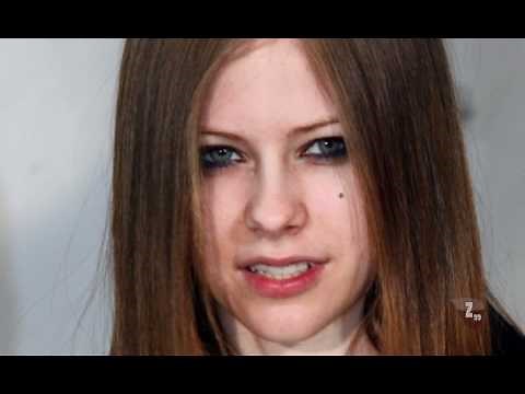 Photoshop Tutorial Deutsch Pickel entfernen (Hautunreinheiten)