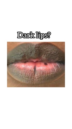 Dark lips prblm try this Home scrub pink soft lips at home #lipcare #naturalglow