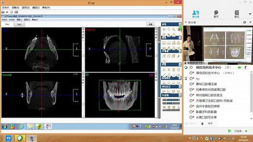 CBCT原理、口腔CT影像学知识及在口腔科中的临床应用范围-4_高清1080P在线观看平台_腾讯视频