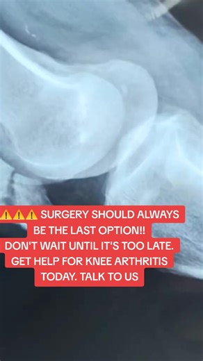 Get Help for Knee Arthritis Before It's Too Late