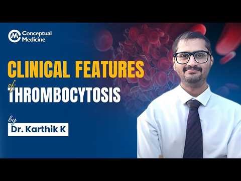 Thrombocytosis | Risk Stratification, Treatment & Exam Key Points | Dr. Karthik K