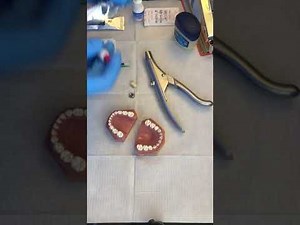 Glass ionomer dental sealant - MacIntyre finger technique (Equia)