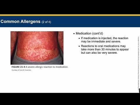 EMT- Chapter 21 Lecture - Allergy and Anaphylaxis
